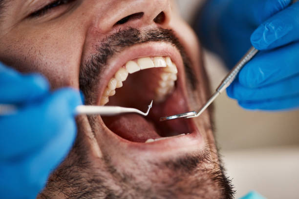 Best Emergency Dentist for Knocked-Out Tooth in Lagrange, GA