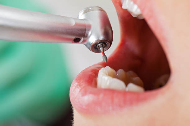 Best Broken or Cracked Tooth Emergency Dentist in Lagrange, GA